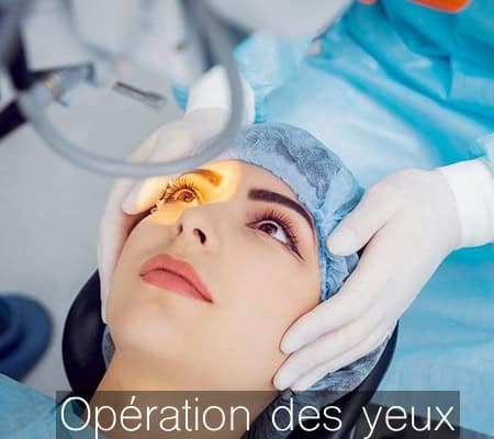 opération des yeux à Marseille, chirurgie réfractive à Marseille -2