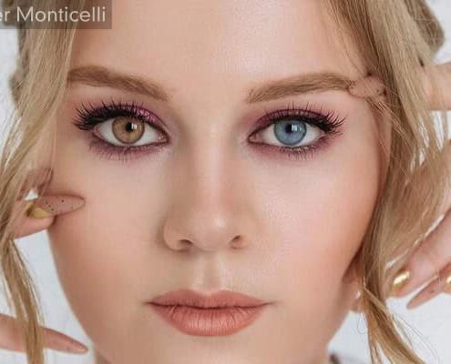 Grâce à la technique de Laser Monticelli, la kératopigmentation offre la possibilité de changer la couleur des yeux - clinique Monticelli Vélodrome Marseille